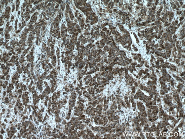 ASPM Antibody in Immunohistochemistry (Paraffin) (IHC (P))