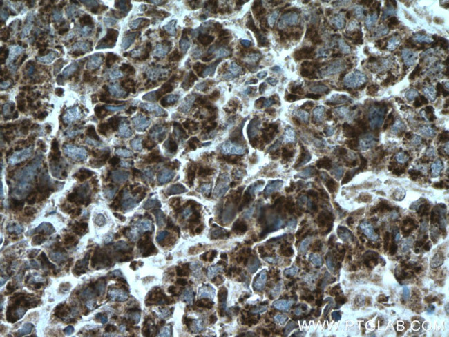 ASPM Antibody in Immunohistochemistry (Paraffin) (IHC (P))