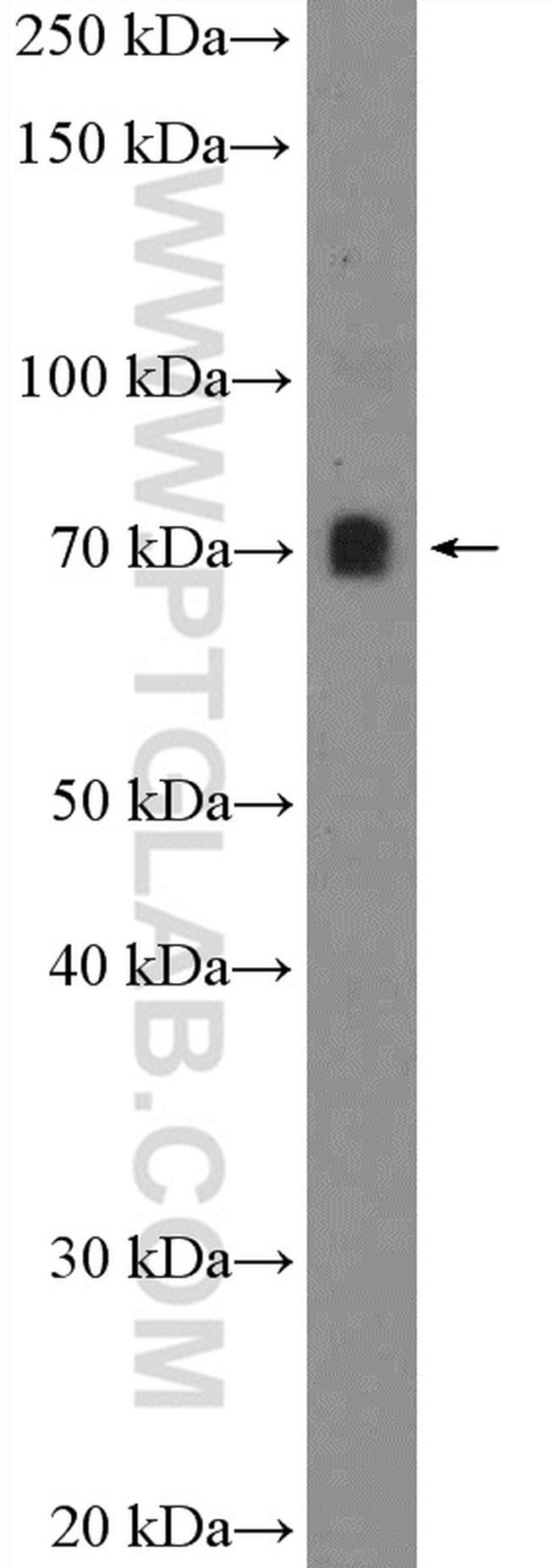 PATZ1 Antibody in Western Blot (WB)