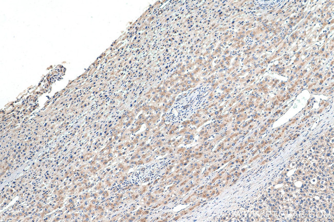 EDEM1 Antibody in Immunohistochemistry (Paraffin) (IHC (P))