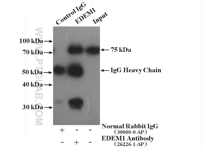 EDEM1 Antibody in Immunoprecipitation (IP)