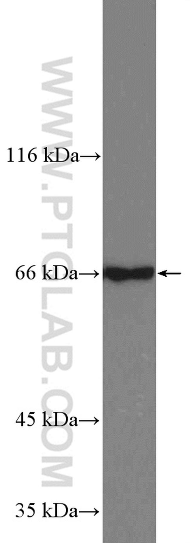 EDEM1 Antibody in Western Blot (WB)