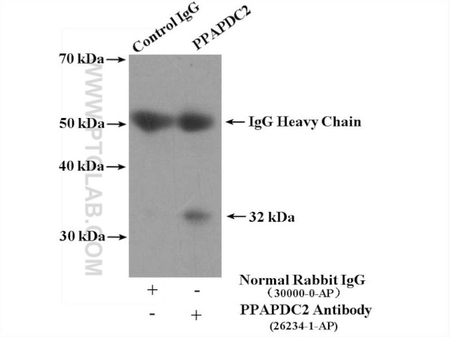 PPAPDC2 Antibody in Immunoprecipitation (IP)