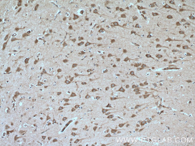 FGF13 Antibody in Immunohistochemistry (Paraffin) (IHC (P))