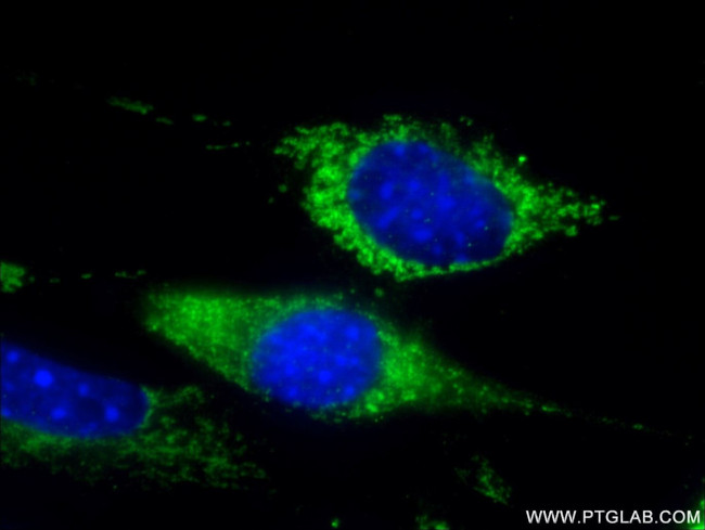 WNT10A Antibody in Immunocytochemistry (ICC/IF)