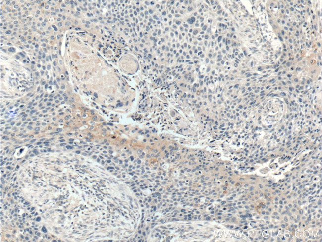 WNT10A Antibody in Immunohistochemistry (Paraffin) (IHC (P))