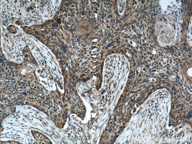 WNT10A Antibody in Immunohistochemistry (Paraffin) (IHC (P))