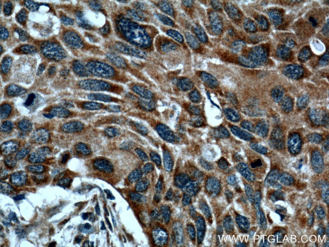 WNT10A Antibody in Immunohistochemistry (Paraffin) (IHC (P))