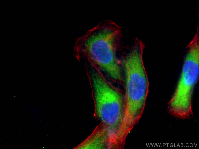 ZC3H15 Antibody in Immunocytochemistry (ICC/IF)