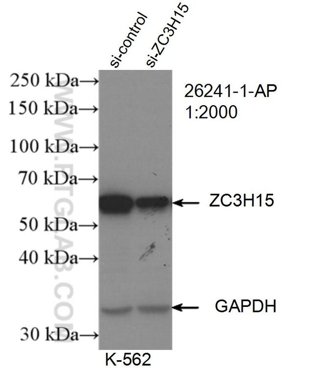 ZC3H15 Antibody in Western Blot (WB)