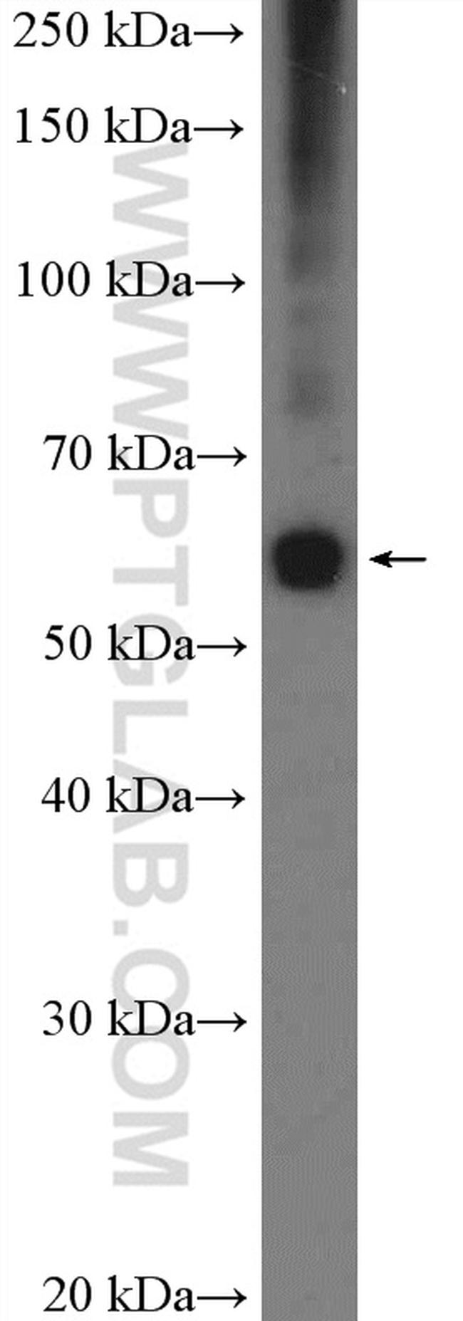 ZC3H15 Antibody in Western Blot (WB)