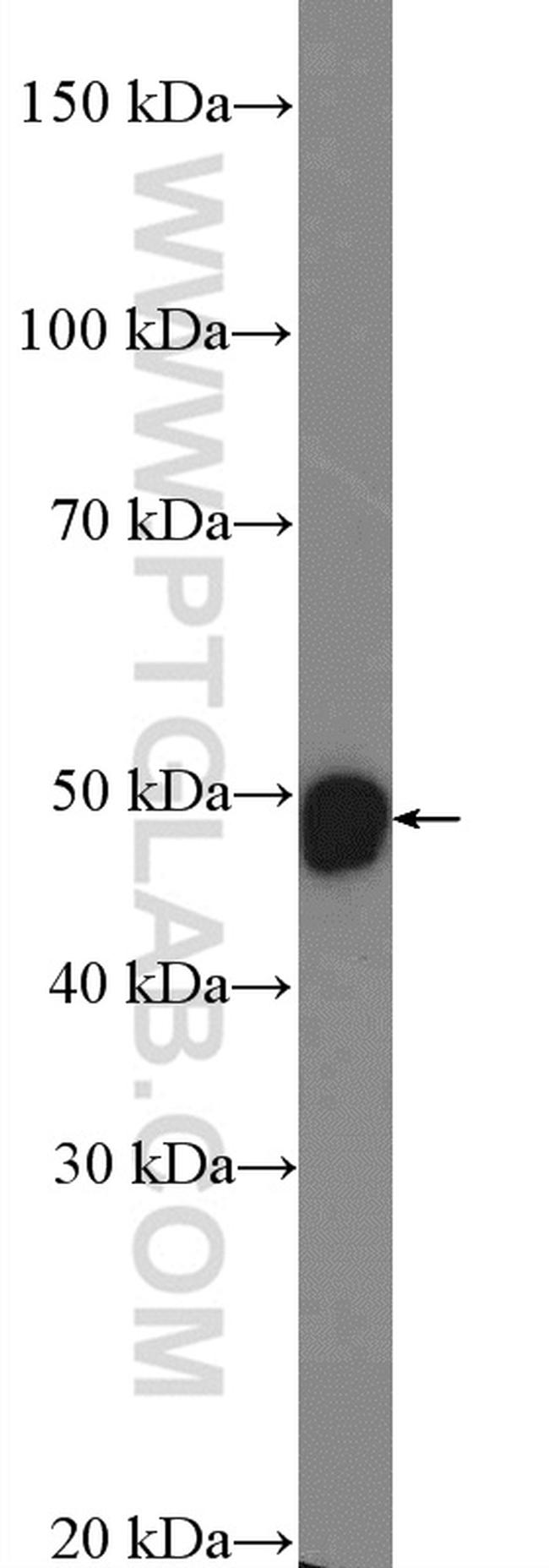 DLX2 Antibody in Western Blot (WB)