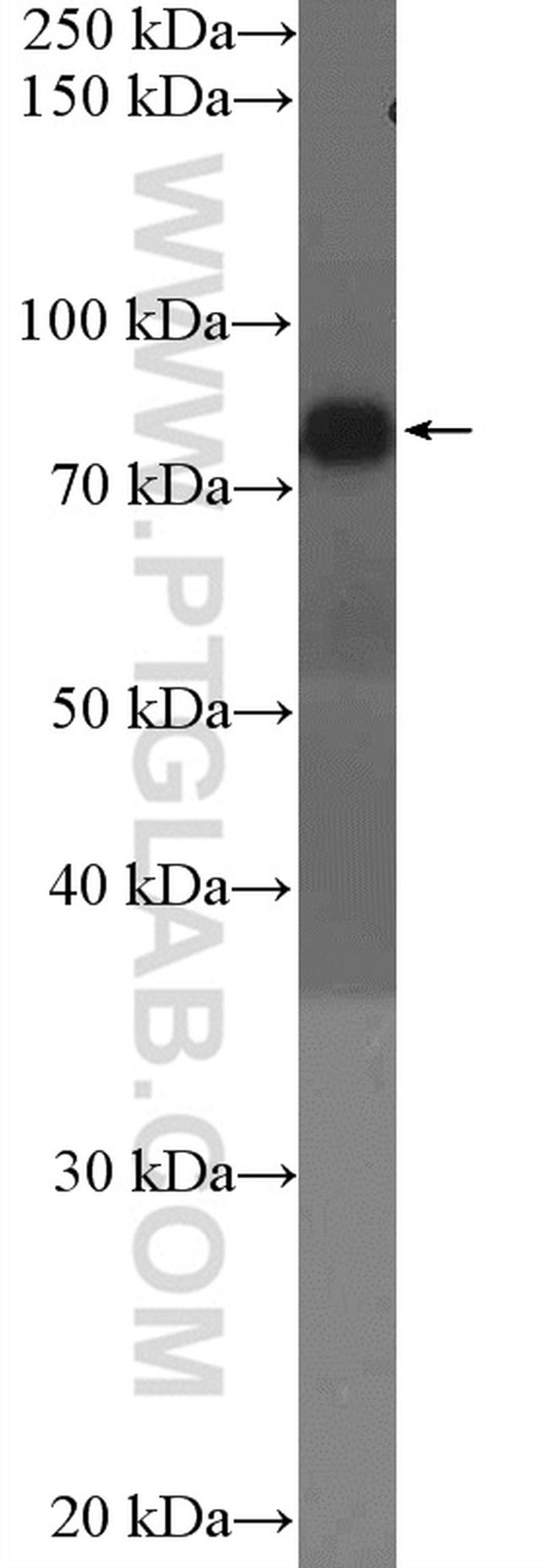 GIT1 Antibody in Western Blot (WB)