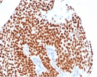 GATA-3 (Breast and Urothelial Marker) Antibody in Immunohistochemistry (Paraffin) (IHC (P))