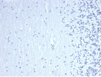GATA-3 (Breast and Urothelial Marker) Antibody in Immunohistochemistry (Paraffin) (IHC (P))