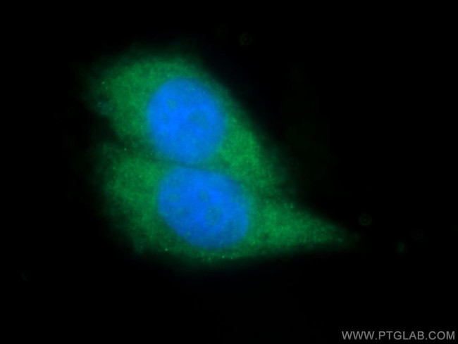 TAOK1 Antibody in Immunocytochemistry (ICC/IF)