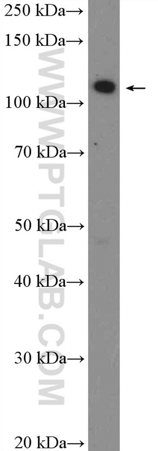 TAOK1 Antibody in Western Blot (WB)