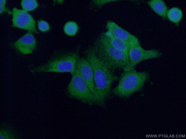 PUM1 Antibody in Immunocytochemistry (ICC/IF)