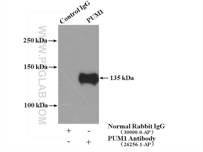 PUM1 Antibody in Immunoprecipitation (IP)