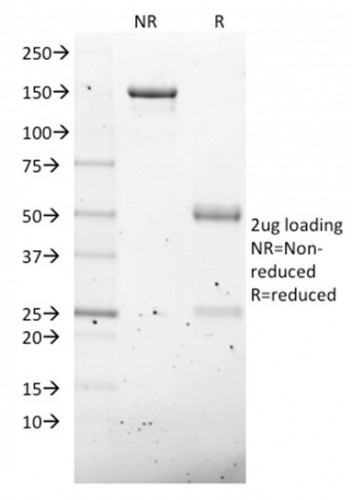 NKX2.8 Antibody in SDS-PAGE (SDS-PAGE)