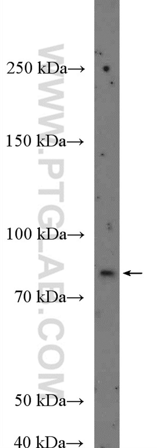 ZXDA Antibody in Western Blot (WB)