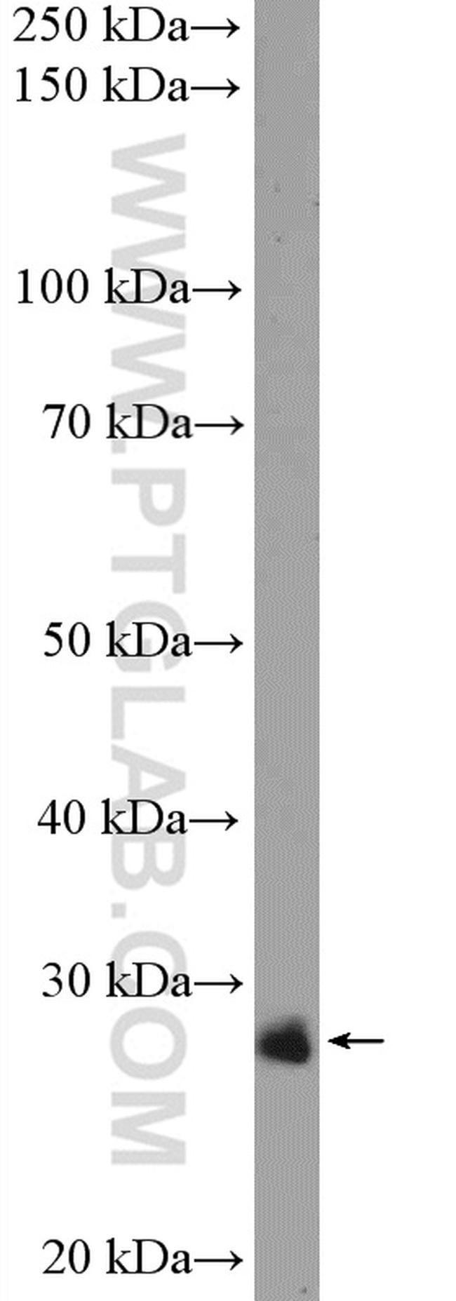 C1orf216 Antibody in Western Blot (WB)