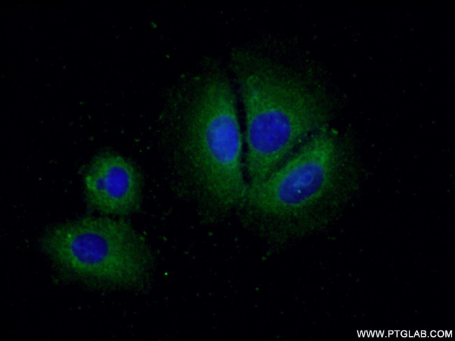 CCM2 Antibody in Immunocytochemistry (ICC/IF)