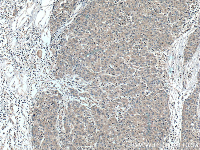 CCM2 Antibody in Immunohistochemistry (Paraffin) (IHC (P))