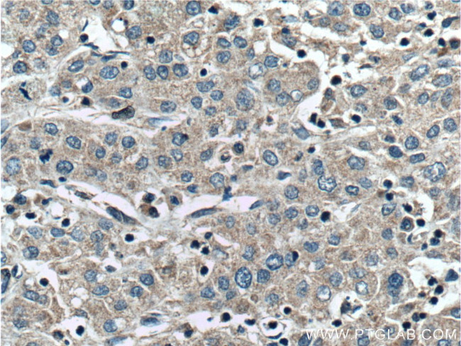 CCM2 Antibody in Immunohistochemistry (Paraffin) (IHC (P))