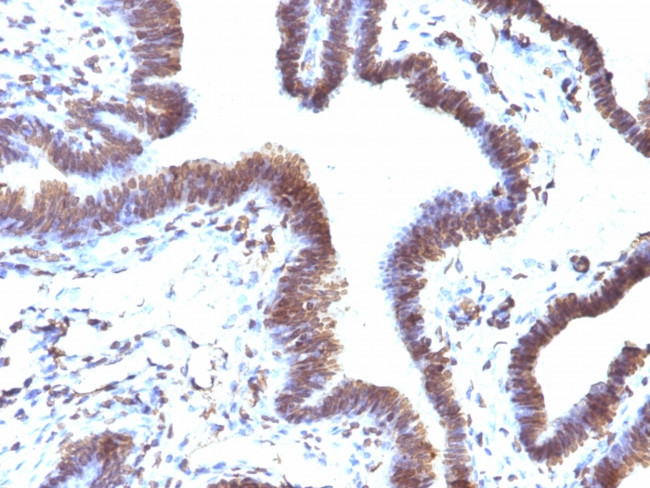 EMI1 (Early Mitotic Inhibitor-1) Antibody in Immunohistochemistry (Paraffin) (IHC (P))