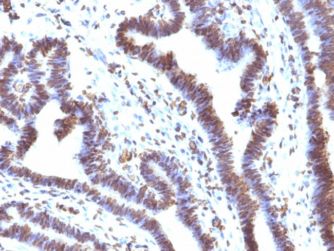 EMI1 (Early Mitotic Inhibitor-1) Antibody in Immunohistochemistry (Paraffin) (IHC (P))