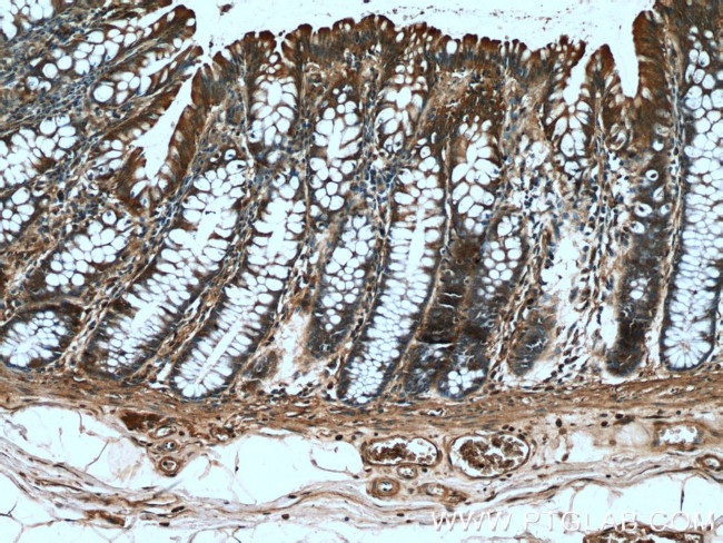 FGF21 Antibody in Immunohistochemistry (Paraffin) (IHC (P))