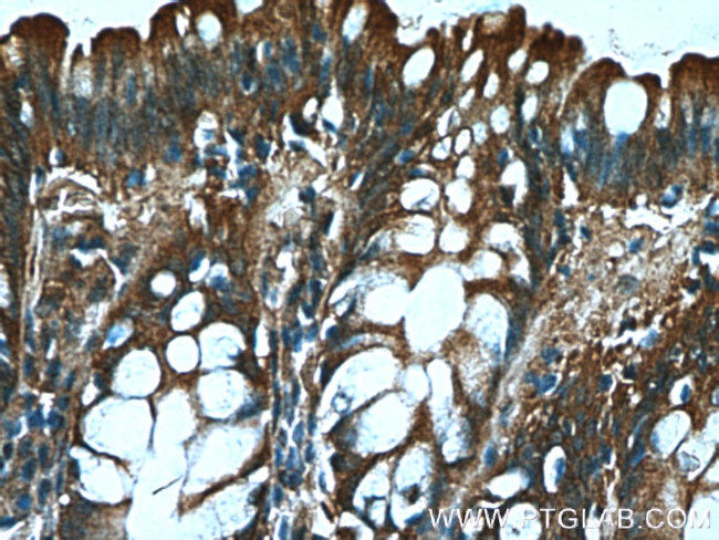 FGF21 Antibody in Immunohistochemistry (Paraffin) (IHC (P))