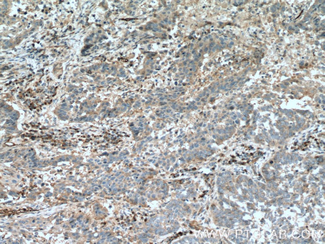 FGF21 Antibody in Immunohistochemistry (Paraffin) (IHC (P))