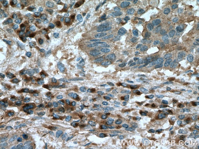 FGF21 Antibody in Immunohistochemistry (Paraffin) (IHC (P))