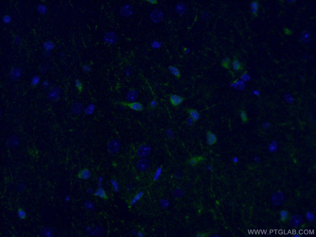 ATG9A Antibody in Immunohistochemistry (PFA fixed) (IHC (PFA))