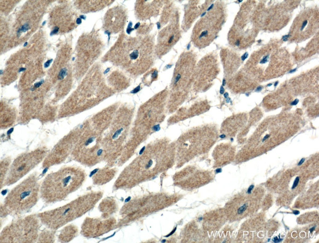 ATG9A Antibody in Immunohistochemistry (Paraffin) (IHC (P))