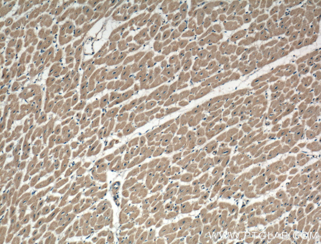 ATG9A Antibody in Immunohistochemistry (Paraffin) (IHC (P))