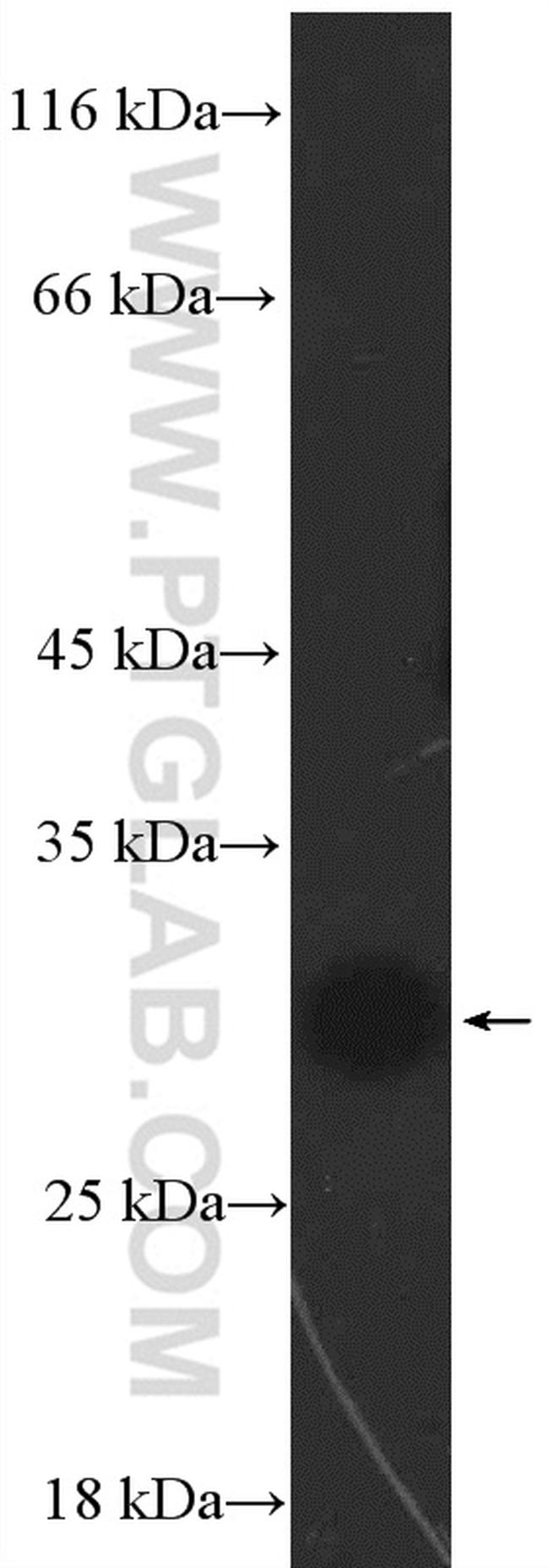 CBX7 Antibody in Western Blot (WB)