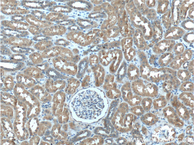 C8orf4 Antibody in Immunohistochemistry (Paraffin) (IHC (P))