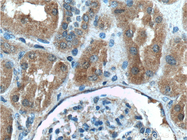 C8orf4 Antibody in Immunohistochemistry (Paraffin) (IHC (P))