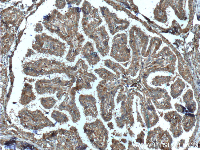 C8orf4 Antibody in Immunohistochemistry (Paraffin) (IHC (P))