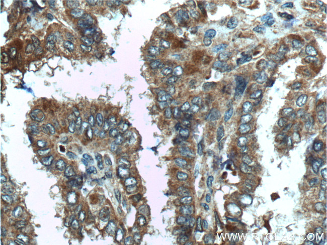 C8orf4 Antibody in Immunohistochemistry (Paraffin) (IHC (P))