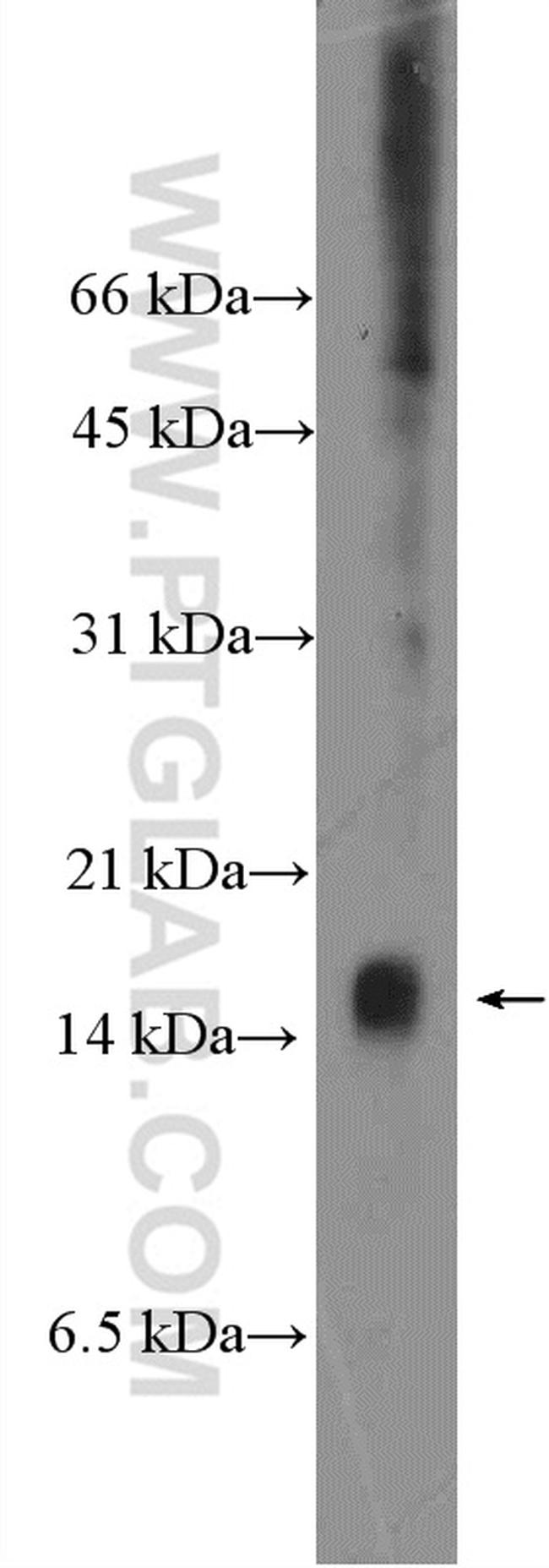 C8orf4 Antibody in Western Blot (WB)