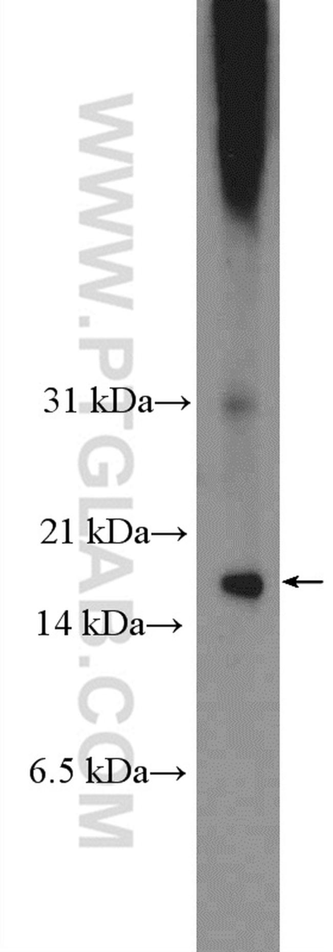 C8orf4 Antibody in Western Blot (WB)