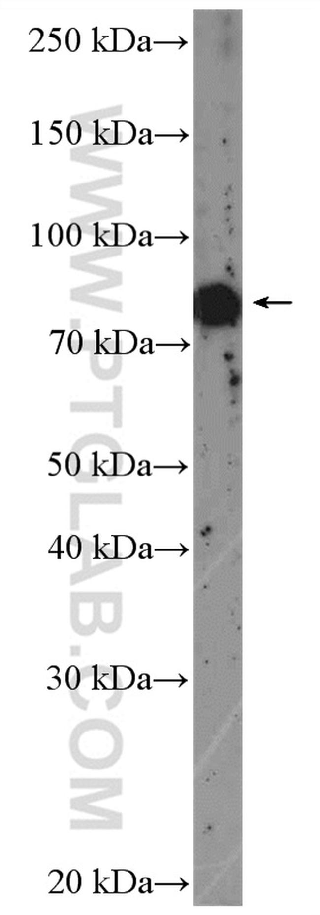 L3MBTL4 Antibody in Western Blot (WB)