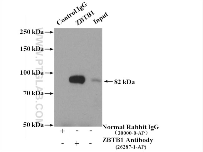 ZBTB1 Antibody in Immunoprecipitation (IP)