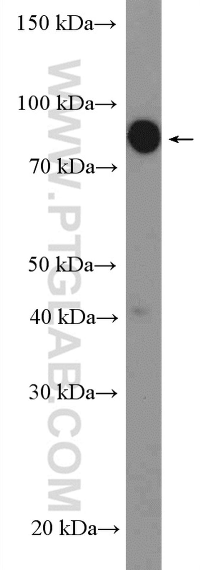 ZBTB1 Antibody in Western Blot (WB)