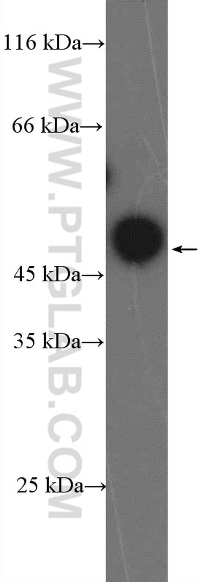 ZNF385A Antibody in Western Blot (WB)