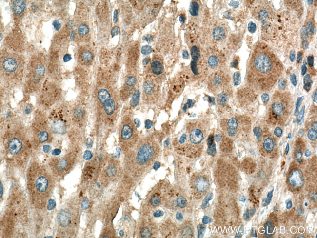 SLC25A47 Antibody in Immunohistochemistry (Paraffin) (IHC (P))